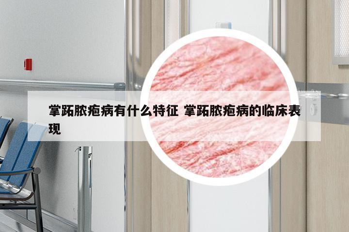 掌跖脓疱病有什么特征 掌跖脓疱病的临床表现
