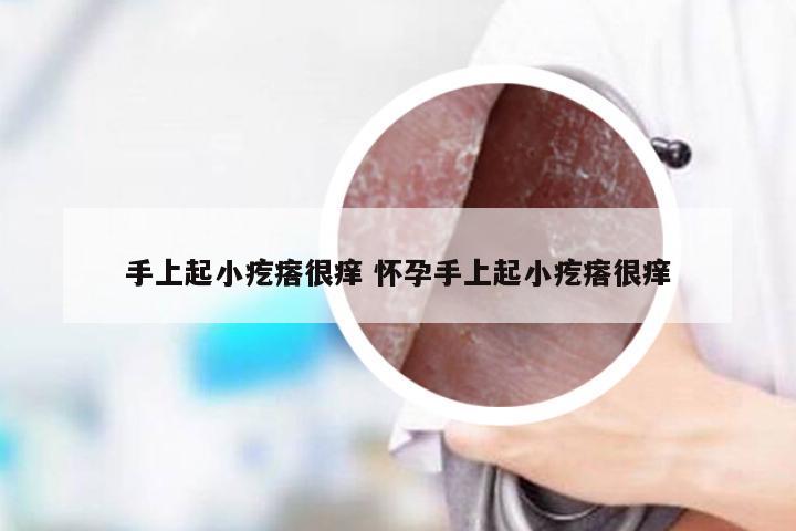 手上起小疙瘩很痒 怀孕手上起小疙瘩很痒