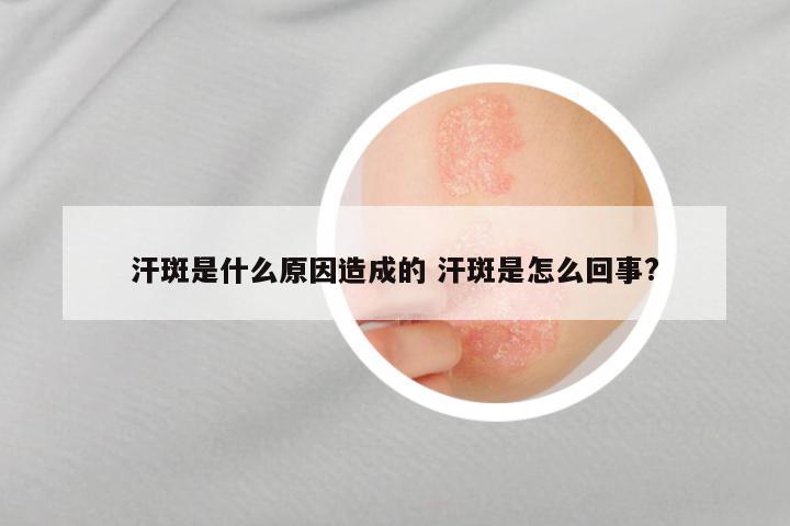 汗斑是什么原因造成的 汗斑是怎么回事?