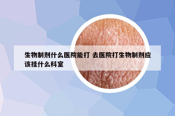 生物制剂什么医院能打 去医院打生物制剂应该挂什么科室