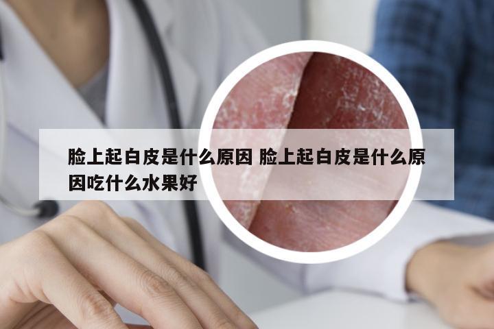 脸上起白皮是什么原因 脸上起白皮是什么原因吃什么水果好