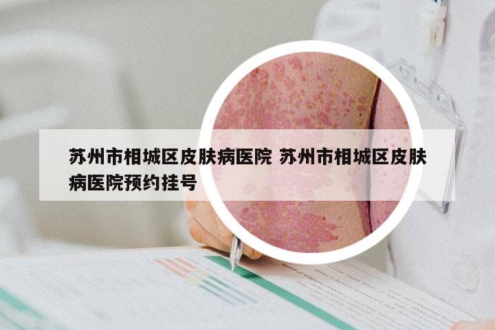 苏州市相城区皮肤病医院 苏州市相城区皮肤病医院预约挂号