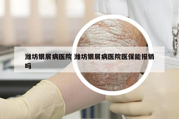 潍坊银屑病医院 潍坊银屑病医院医保能报销吗