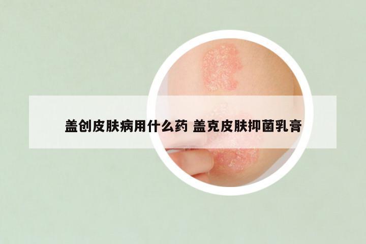 盖创皮肤病用什么药 盖克皮肤抑菌乳膏