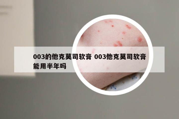 003的他克莫司软膏 003他克莫司软膏能用半年吗