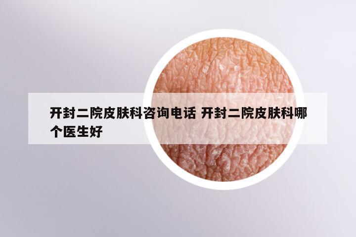 开封二院皮肤科咨询电话 开封二院皮肤科哪个医生好