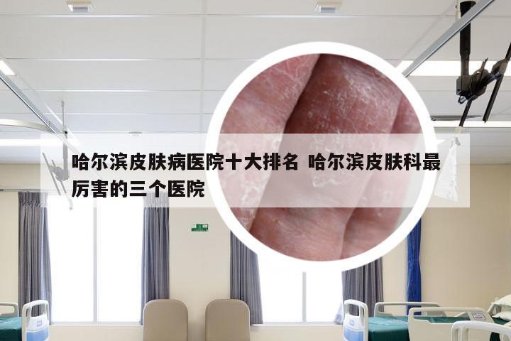 哈尔滨皮肤病医院十大排名 哈尔滨皮肤科最厉害的三个医院