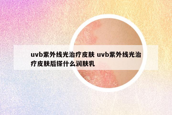 uvb紫外线光治疗皮肤 uvb紫外线光治疗皮肤后搽什么润肤乳