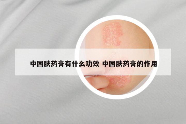 中国肤药膏有什么功效 中国肤药膏的作用
