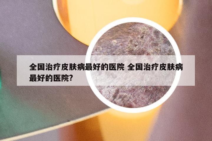 全国治疗皮肤病最好的医院 全国治疗皮肤病最好的医院?