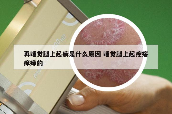 再睡觉腿上起癣是什么原因 睡觉腿上起疙瘩痒痒的