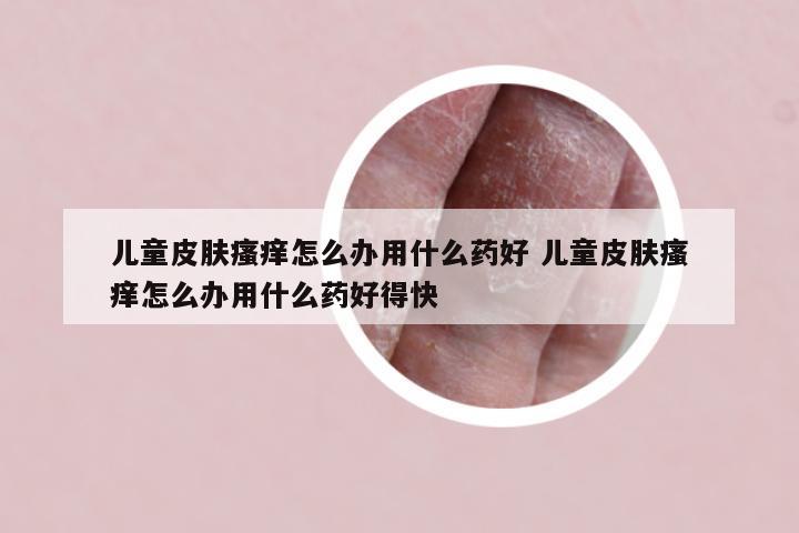 儿童皮肤瘙痒怎么办用什么药好 儿童皮肤瘙痒怎么办用什么药好得快