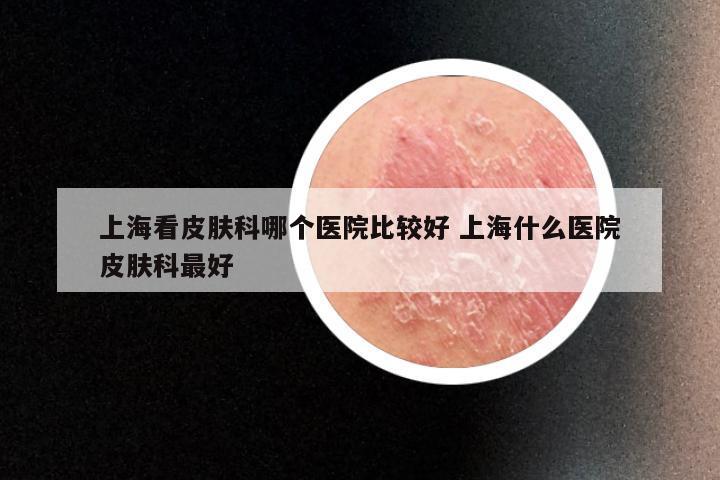 上海看皮肤科哪个医院比较好 上海什么医院皮肤科最好