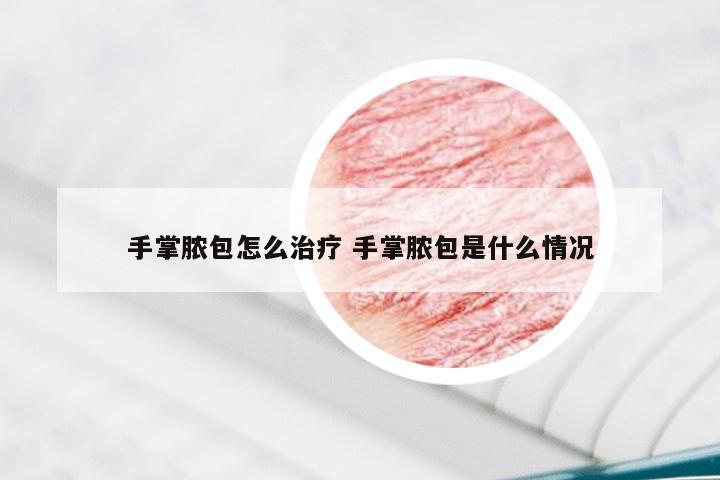 手掌脓包怎么治疗 手掌脓包是什么情况