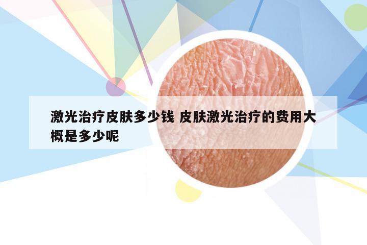激光治疗皮肤多少钱 皮肤激光治疗的费用大概是多少呢
