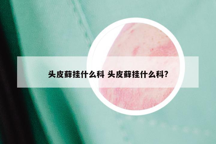 头皮藓挂什么科 头皮藓挂什么科?