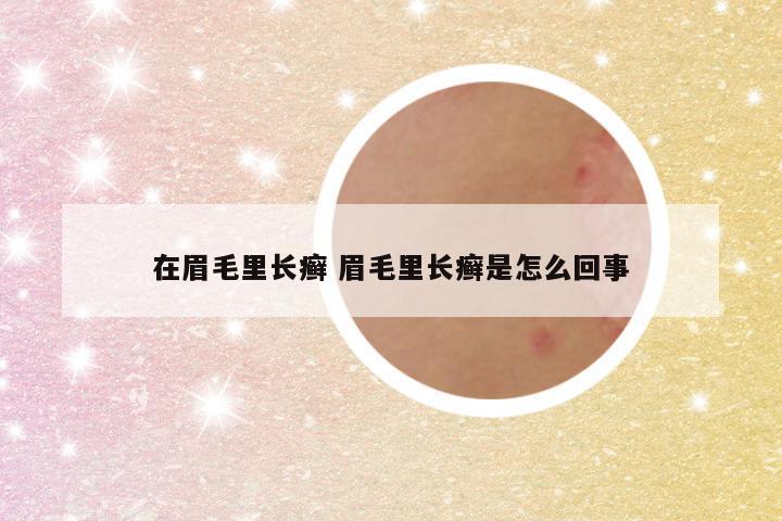 在眉毛里长癣 眉毛里长癣是怎么回事