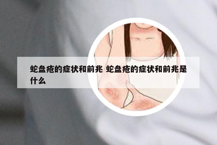 蛇盘疮的症状和前兆 蛇盘疮的症状和前兆是什么