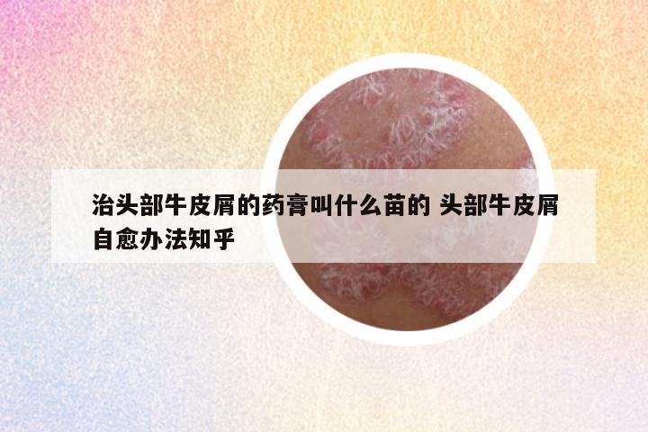 治头部牛皮屑的药膏叫什么苗的 头部牛皮屑自愈办法知乎