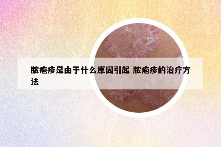 脓疱疹是由于什么原因引起 脓疱疹的治疗方法