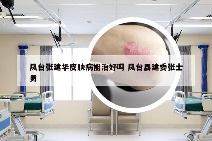 凤台张建华皮肤病能治好吗 凤台县建委张士勇