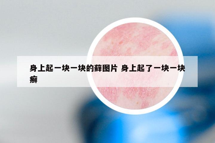 身上起一块一块的藓图片 身上起了一块一块癣