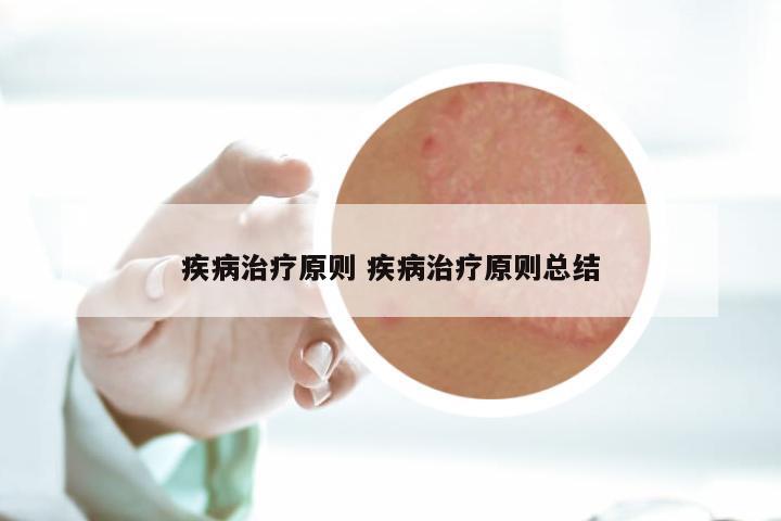 疾病治疗原则 疾病治疗原则总结