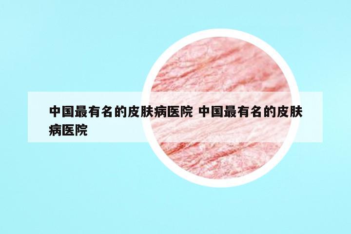 中国最有名的皮肤病医院 中国最有名的皮肤病医院