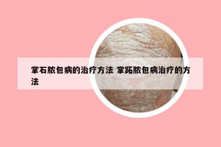 掌石脓包病的治疗方法 掌跖脓包病治疗的方法