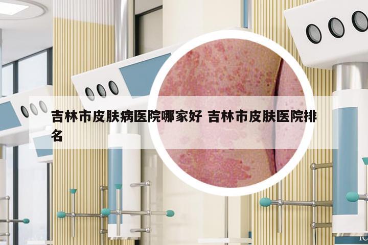 吉林市皮肤病医院哪家好 吉林市皮肤医院排名