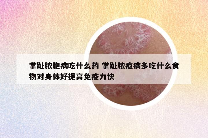 掌趾脓胞病吃什么药 掌趾脓疱病多吃什么食物对身体好提高免疫力快