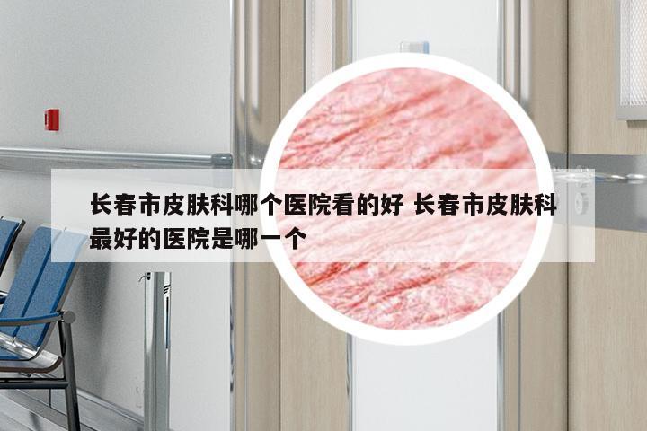 长春市皮肤科哪个医院看的好 长春市皮肤科最好的医院是哪一个
