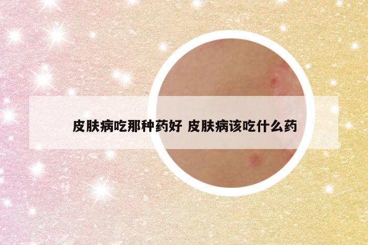 皮肤病吃那种药好 皮肤病该吃什么药