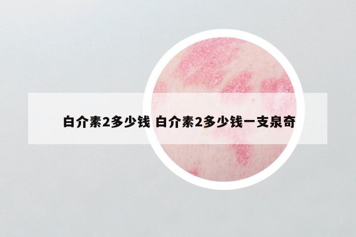 白介素2多少钱 白介素2多少钱一支泉奇
