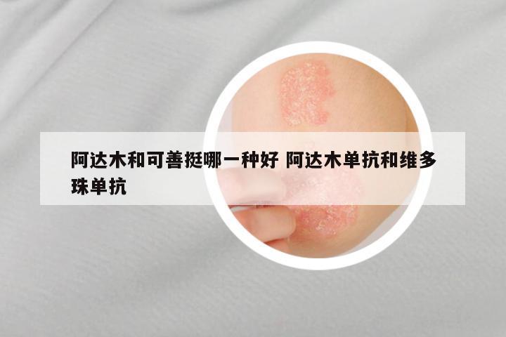 阿达木和可善挺哪一种好 阿达木单抗和维多珠单抗
