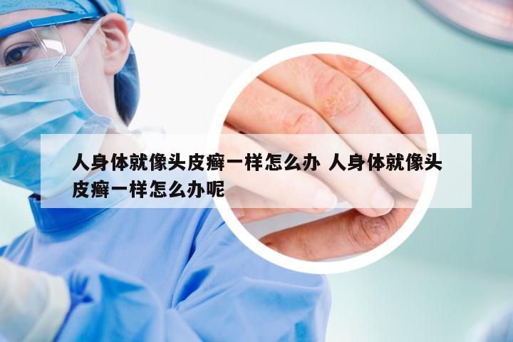 人身体就像头皮癣一样怎么办 人身体就像头皮癣一样怎么办呢