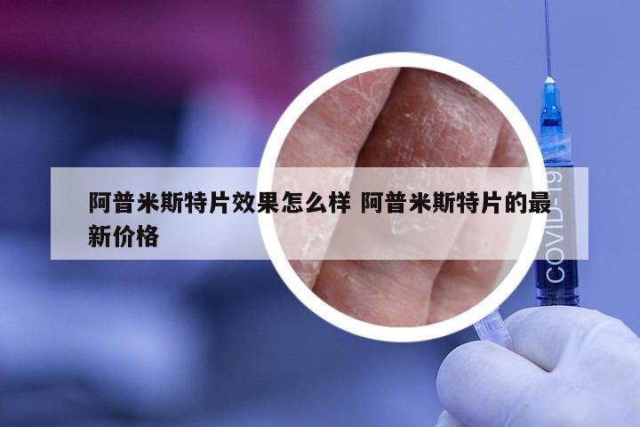 阿普米斯特片效果怎么样 阿普米斯特片的最新价格