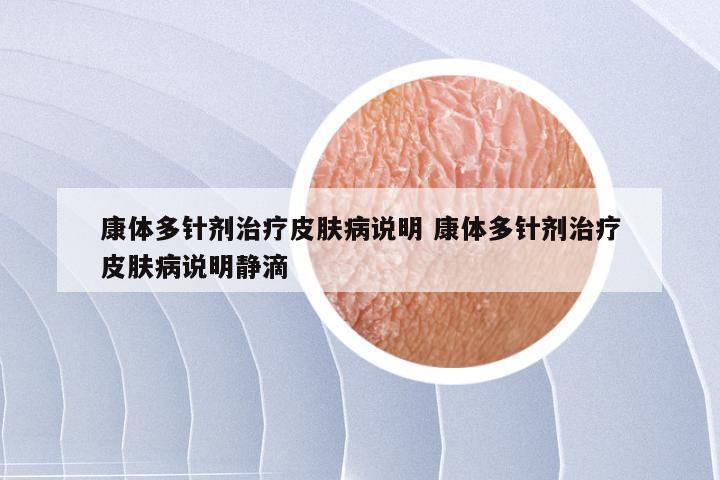 康体多针剂治疗皮肤病说明 康体多针剂治疗皮肤病说明静滴