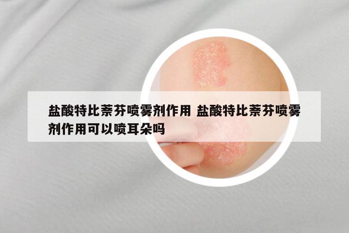 盐酸特比萘芬喷雾剂作用 盐酸特比萘芬喷雾剂作用可以喷耳朵吗