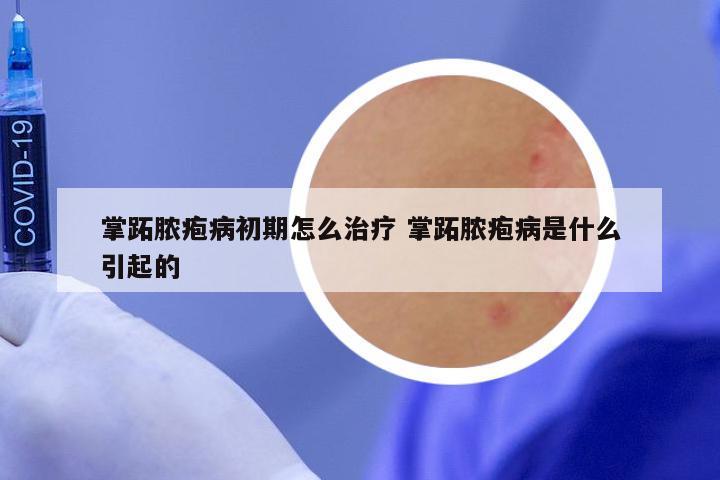 掌跖脓疱病初期怎么治疗 掌跖脓疱病是什么引起的