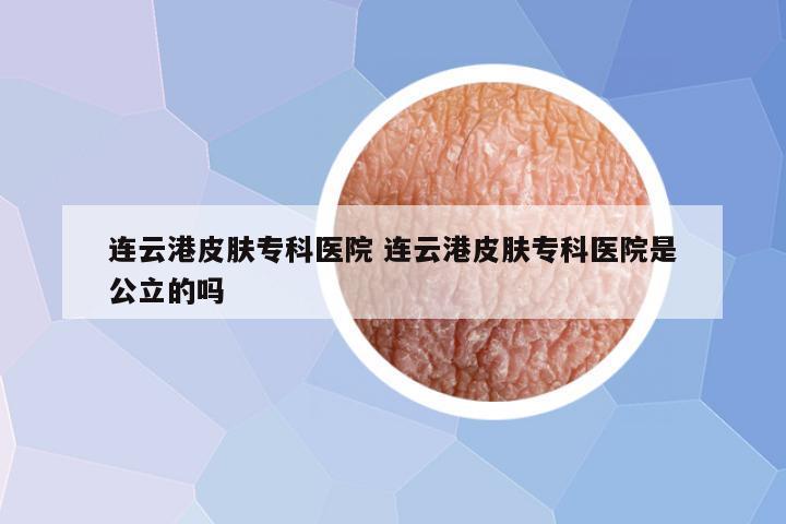 连云港皮肤专科医院 连云港皮肤专科医院是公立的吗