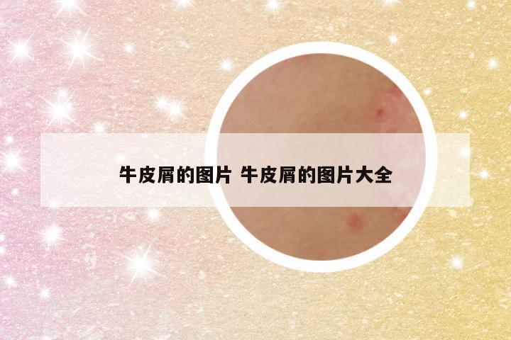 牛皮屑的图片 牛皮屑的图片大全