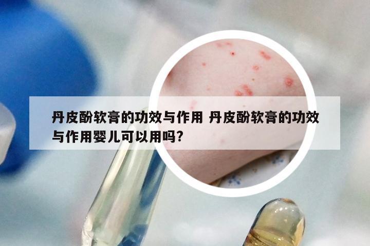 丹皮酚软膏的功效与作用 丹皮酚软膏的功效与作用婴儿可以用吗?