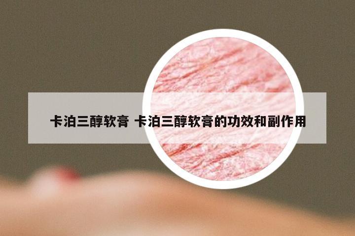 卡泊三醇软膏 卡泊三醇软膏的功效和副作用