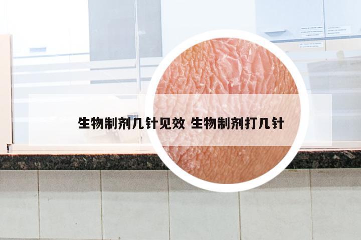 生物制剂几针见效 生物制剂打几针