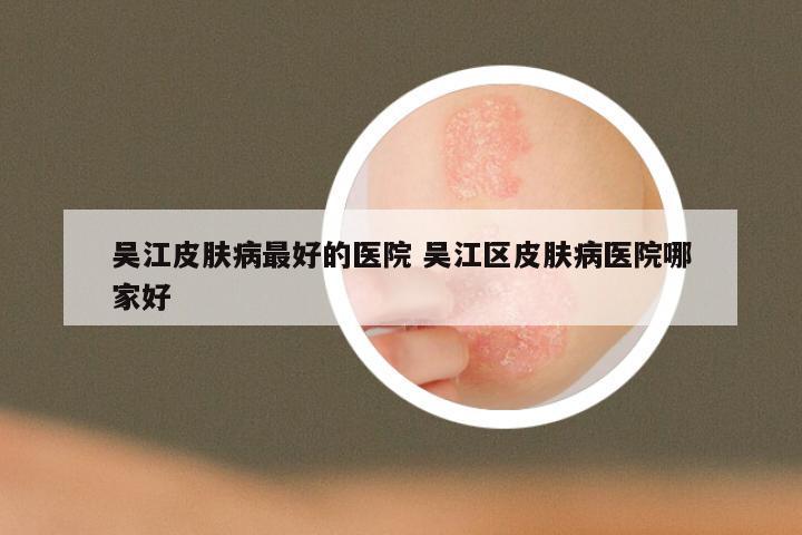 吴江皮肤病最好的医院 吴江区皮肤病医院哪家好