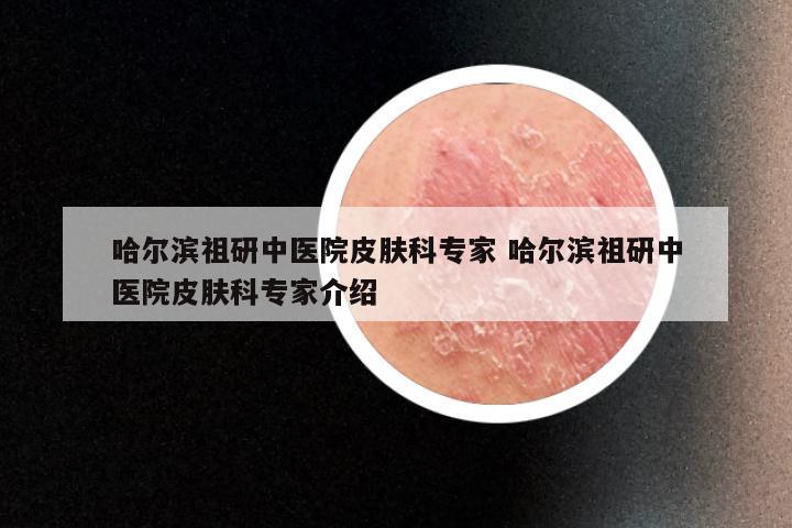 哈尔滨祖研中医院皮肤科专家 哈尔滨祖研中医院皮肤科专家介绍