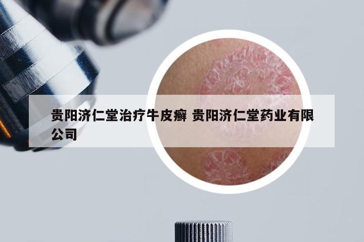贵阳济仁堂治疗牛皮癣 贵阳济仁堂药业有限公司