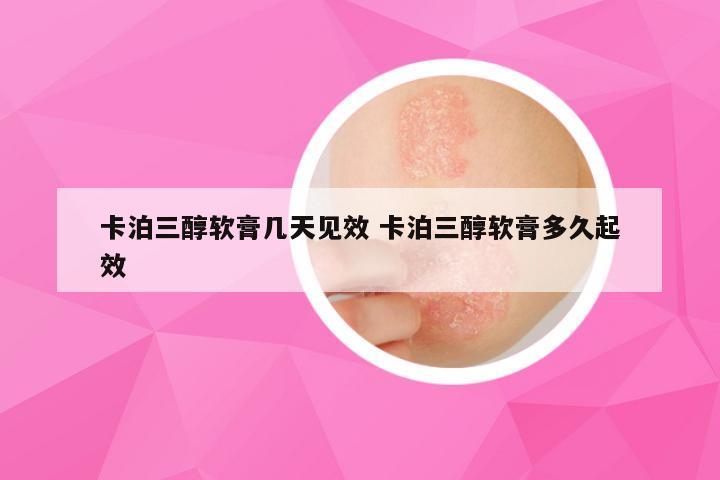 卡泊三醇软膏几天见效 卡泊三醇软膏多久起效