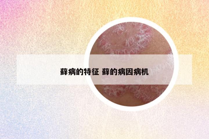 藓病的特征 藓的病因病机